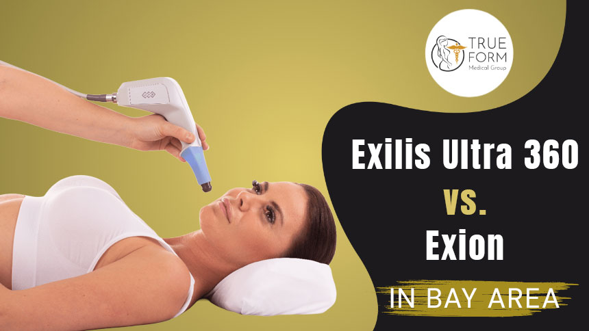 Exilis Ultra 360 vs Exion in Oakland